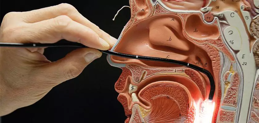 Endoscopía laríngea, nasal y de oído